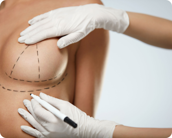 How Much Does A Breast Lift Cost?