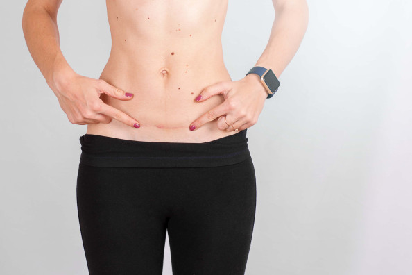 How much does Tummy Tuck  cost in Turkey?