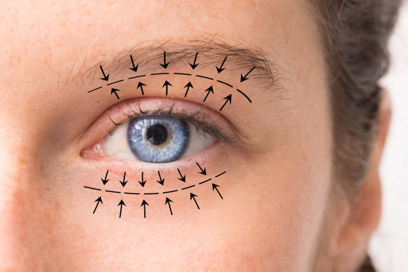 What eyelid surgery can treat ?